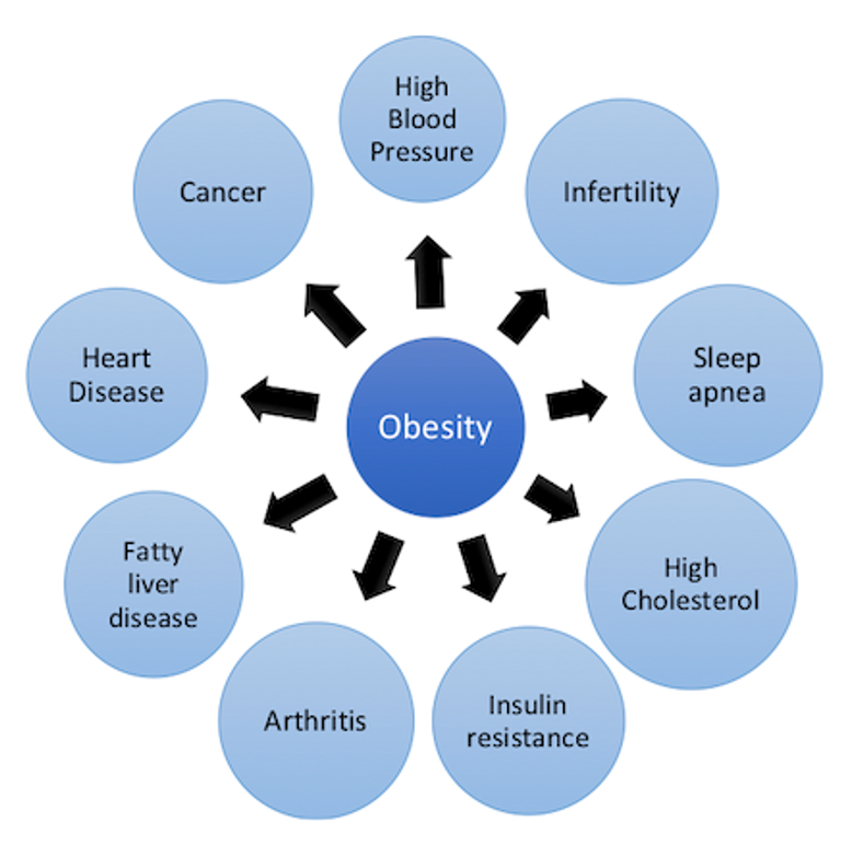 Why Do You Think Think Obesity Is Linked To How Rich Or Poor We Are?