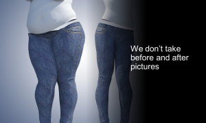 Heartland Weight Loss doesn't take before and after pictures